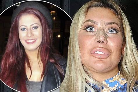 chloe ferry then and now|chloe cherry before plastic surgery.